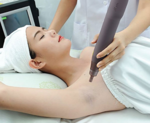 Cách Trị Thâm Nách Đơn Giản, Hiệu Quả Và Nhanh Chóng