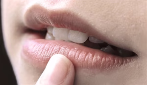Khử Thâm Môi: Bí Quyết Cho Đôi Môi Hồng Hàm Hấp Dẫn, Không Cần Kiêng Khem